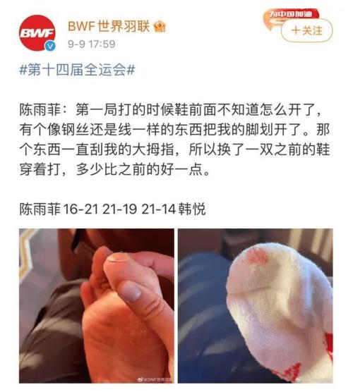 李宁回应鞋子伤脚(李宁回应鞋子造成的足部不适问题)